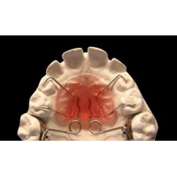 牙齿矫正器厂家 - 正畸牙齿保持器牙齿矫正器厂家批发价格